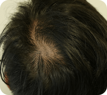 ${"id":"t1_s0307_img2", "name":"Section 3 - Image 2 (Alt)", "type":"info"