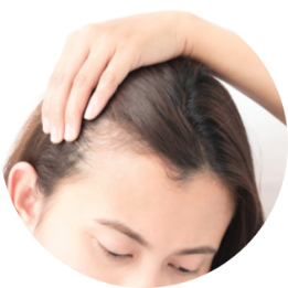 脫髮原因
