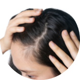 頭髮不明顯稀疏的人士