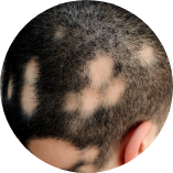 ${"id":"t1_s0307_img2", "name":"Section 3 - Image 2 (Alt)", "type":"info"