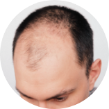 ${"id":"t1_s0307_img2", "name":"Section 3 - Image 2 (Alt)", "type":"info"