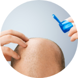 接近全禿的人士