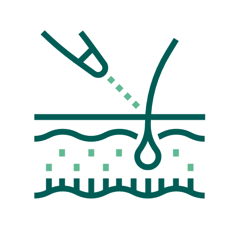 醫學級
軟激光生髮治療