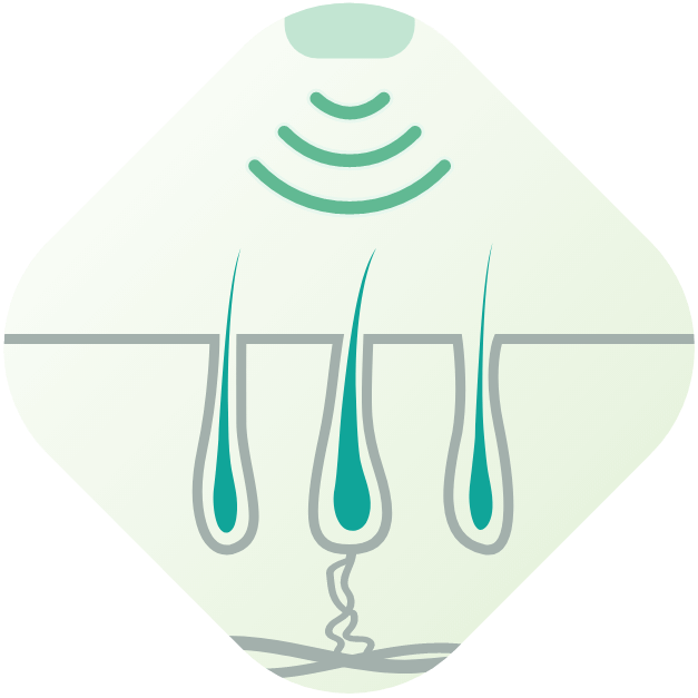 低能量生髮激光激活毛囊生長